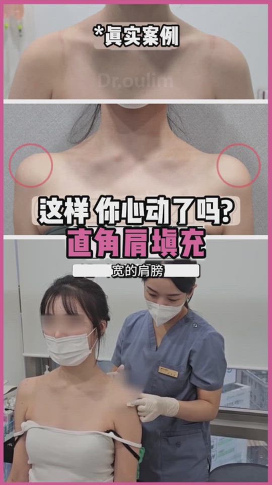 为什么要做肩膀填充？