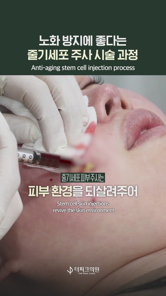 Is skin stem cell treatment really as good as people say?