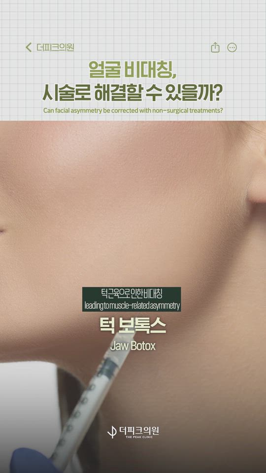 Can facial asymmetry be corrected with cosmetic treatments?