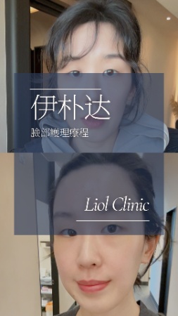 三娃辣妈的保养秘诀？丽奥医院无痛高端提升