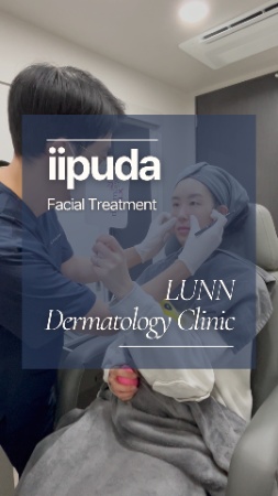 Natural Filler Experience at LUNN Dermatology Clinic